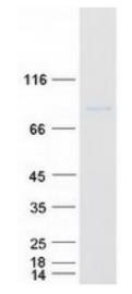 SDS-PAGE (TNFAIP3-1013HFL).jpg